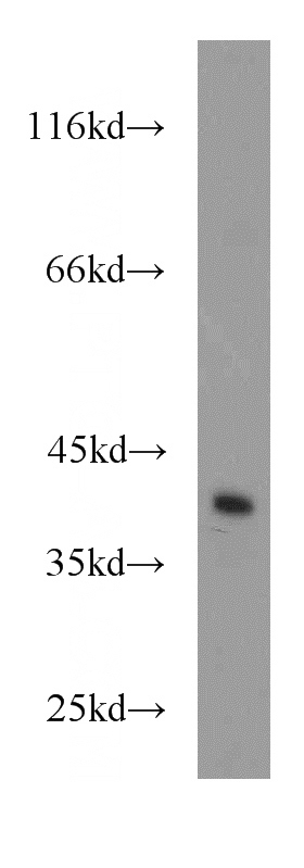 MCF7 cells were subjected to SDS PAGE followed by western blot with Catalog No:109160(CDK3 antibody) at dilution of 1:800