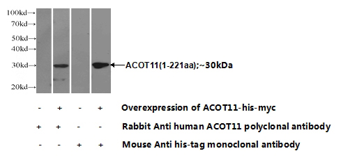 Transfected HEK-293 cells were subjected to SDS PAGE followed by western blot with Catalog No:107743(ACOT11 Antibody) at dilution of 1:1000