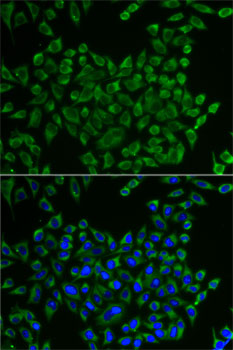 Immunofluorescence - MRPS30 Polyclonal Antibody 