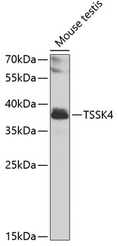 Western blot - TSSK4 Polyclonal Antibody 