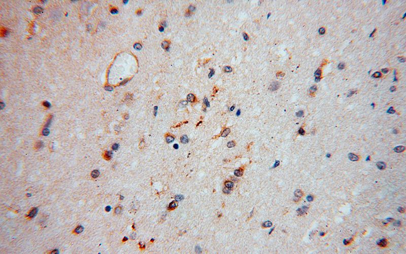 Immunohistochemical of paraffin-embedded human brain using Catalog No:109184(CEP68 antibody) at dilution of 1:100 (under 40x lens)
