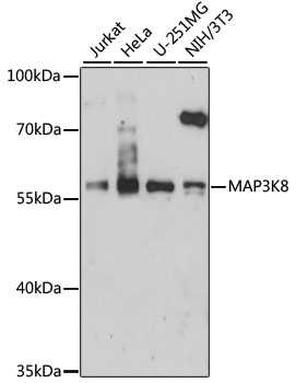 Western blot - MAP3K8 Polyclonal Antibody 
