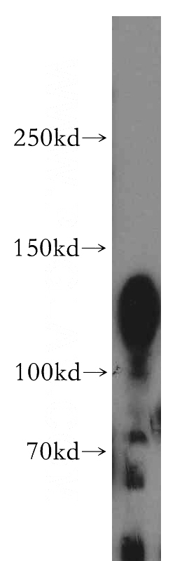 A431 cells were subjected to SDS PAGE followed by western blot with Catalog No:113922(PKP4 antibody) at dilution of 1:300