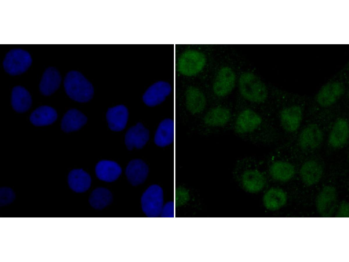 Fig2:; ICC staining of PDK1 in Hela cells (green). Formalin fixed cells were permeabilized with 0.1% Triton X-100 in TBS for 10 minutes at room temperature and blocked with 1% Blocker BSA for 15 minutes at room temperature. Cells were probed with the primary antibody ( 1/50) for 1 hour at room temperature, washed with PBS. Alexa Fluor®488 Goat anti-Rabbit IgG was used as the secondary antibody at 1/1,000 dilution. The nuclear counter stain is DAPI (blue).