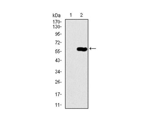 Fig2: Western blot analysis of DCTN4 on HEK293 (1) and DCTN4-hIgGFc transfected HEK293 (2) cell lysate using anti-DCTN4 antibody at 1/1,000 dilution.