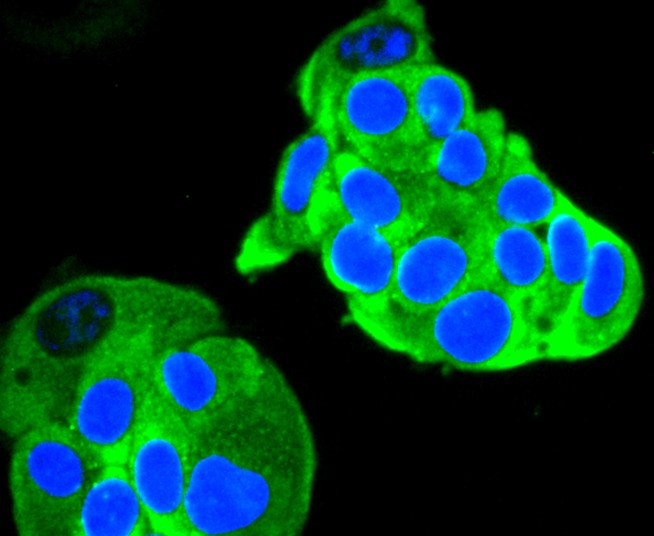 Fig3:; ICC staining of Ret in MCF-7 cells (green). Formalin fixed cells were permeabilized with 0.1% Triton X-100 in TBS for 10 minutes at room temperature and blocked with 1% Blocker BSA for 15 minutes at room temperature. Cells were probed with the primary antibody ( 1/50) for 1 hour at room temperature, washed with PBS. Alexa Fluor®488 Goat anti-Rabbit IgG was used as the secondary antibody at 1/1,000 dilution. The nuclear counter stain is DAPI (blue).