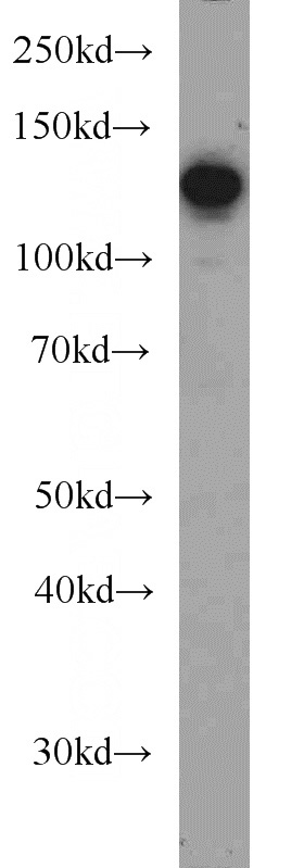 HEK-293 cells were subjected to SDS PAGE followed by western blot with Catalog No:108951(CC2D1A antibody) at dilution of 1:1000