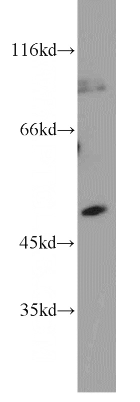 K-562 cells were subjected to SDS PAGE followed by western blot with Catalog No:115180(SH2D2A antibody) at dilution of 1:800