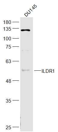 Fig2: Sample:; DU145(Human) Cell Lysate at 30 ug; Primary: Anti-ILDR1 at 1/300 dilution; Secondary: IRDye800CW Goat Anti-Rabbit IgG at 1/20000 dilution; Predicted band size: 60 kD; Observed band size: 56 kD