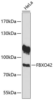 Western blot - FBXO42 Polyclonal Antibody 