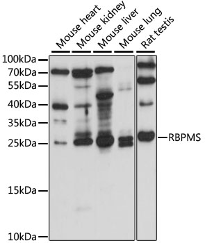 Western blot - RBPMS Polyclonal Antibody 