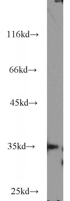 A431 cells were subjected to SDS PAGE followed by western blot with Catalog No:116049(THoc6 antibody) at dilution of 1:500