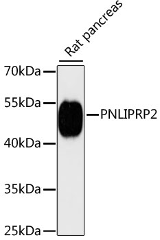 Western blot - PNLIPRP2 Polyclonal Antibody 