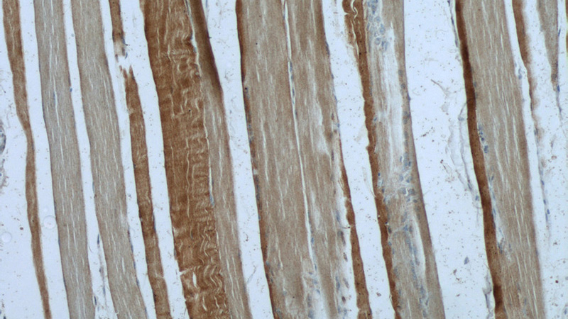 Immunohistochemistry of paraffin-embedded human skeletal muscle tissue slide using Catalog No:113772(PFKM Antibody) at dilution of 1:50 (under 10x lens)