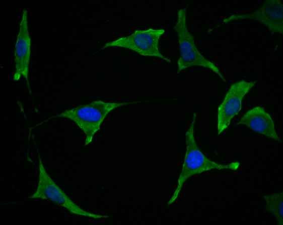 Fig3: ICC staining Tmem248 in SH-SY-5Y cells (green). The nuclear counter stain is DAPI (blue). Cells were fixed in paraformaldehyde, permeabilised with 0.25% Triton X100/PBS.