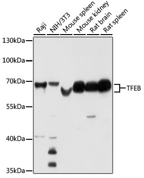 Western blot - TFEB Polyclonal Antibody 