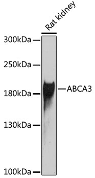 Western blot - ABCA3 Polyclonal Antibody 