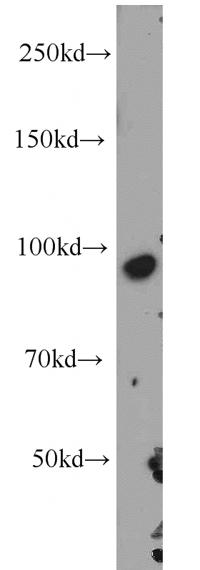 MCF7 cells were subjected to SDS PAGE followed by western blot with Catalog No:116331(CD71 antibody) at dilution of 1:1000