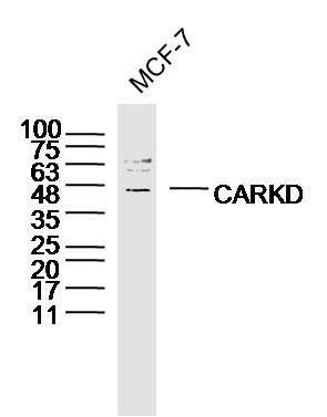 Fig1: Sample: MCF-7 Cell(Human)Lysate at 30 ug; Primary: Anti-CARKD at 1/300 dilution; Secondary: IRDye800CW Goat Anti-Rabbit IgG at 1/20000 dilution; Predicted band size: 37kD; Observed band size: 45kD