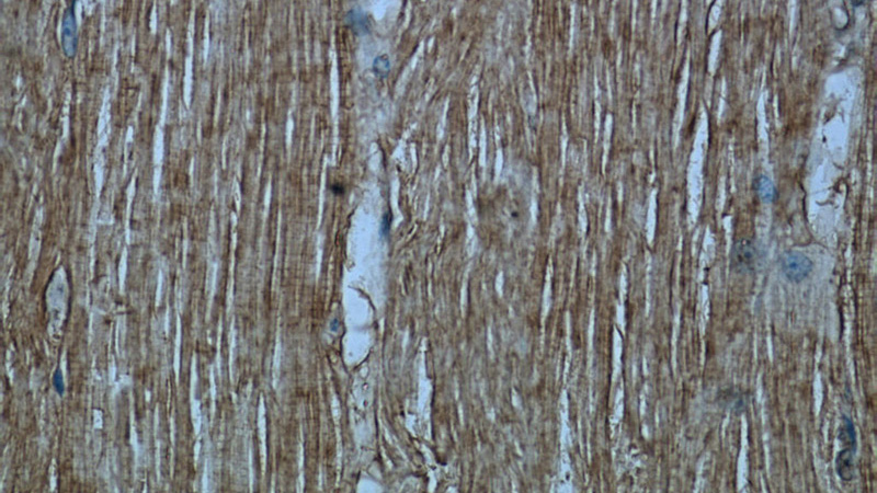 Immunohistochemical of paraffin-embedded human skeletal muscle using Catalog No:108260(ARHGAP10 antibody) at dilution of 1:50 (under 40x lens)
