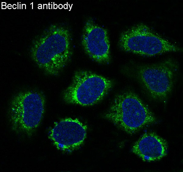 Immunofluorescent analysis of Hela cells, using Beclin 1 Antibody.