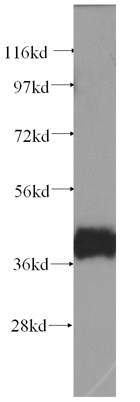 human skeletal muscle tissue were subjected to SDS PAGE followed by western blot with Catalog No:108976(CCDC5 antibody) at dilution of 1:500