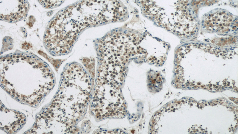 Immunohistochemistry of paraffin-embedded human testis tissue slide using Catalog No:110895(GBP6 Antibody) at dilution of 1:50 (under 10x lens)