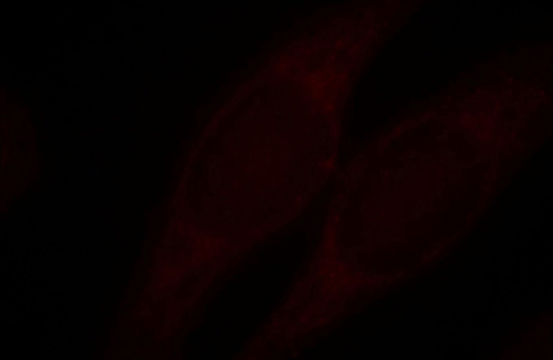 Immunofluorescent analysis of Hela cells, using TRIM15 antibody Catalog No:116299 at 1:25 dilution and Rhodamine-labeled goat anti-rabbit IgG (red).
