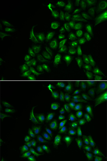 Immunofluorescence - TSPAN7 Polyclonal Antibody 