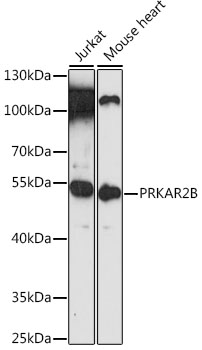 Western blot - PRKAR2B Polyclonal Antibody 