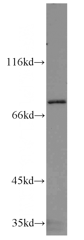 NIH/3T3 cells were subjected to SDS PAGE followed by western blot with Catalog No:114715(RIPK1-Specific antibody) at dilution of 1:300