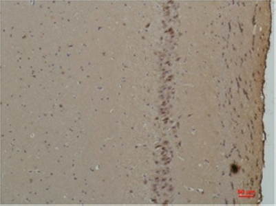 Fig2:; Immunohistochemical analysis of paraffin-embedded Rat Brain Tissue using CABP Rabbit pAb diluted at 1:200.