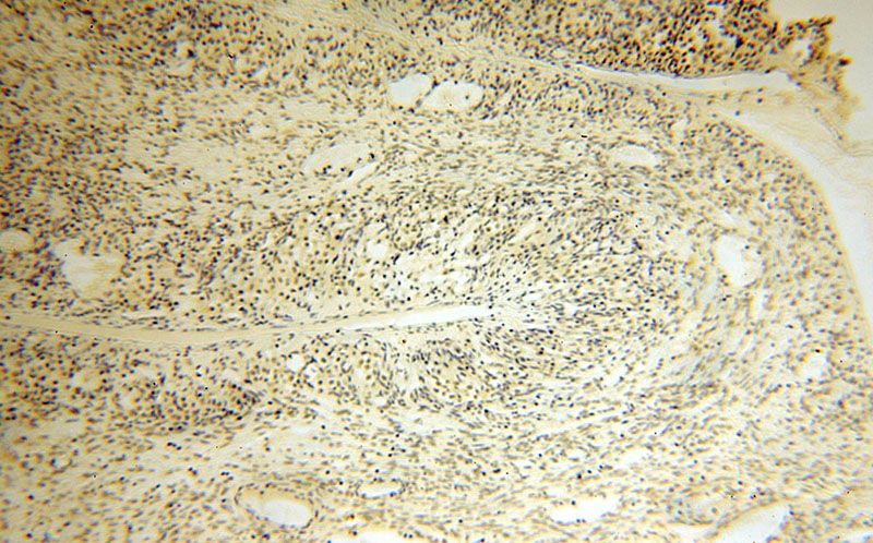 Immunohistochemical of paraffin-embedded human ovary using Catalog No:112179(LDB1 antibody) at dilution of 1:50 (under 10x lens)