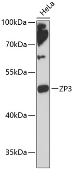 Western blot - ZP3 Polyclonal Antibody 