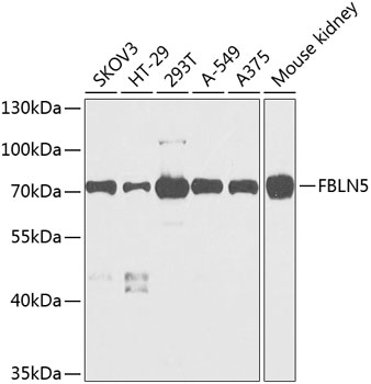 Western blot - FBLN5 Polyclonal Antibody 
