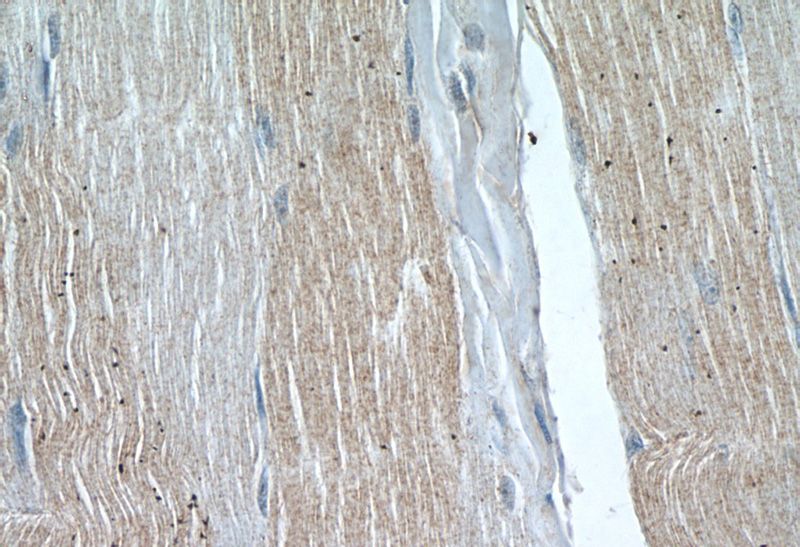 Immunohistochemistry of paraffin-embedded human skeletal muscle tissue slide using Catalog No:116499(PEO1 Antibody) at dilution of 1:50 (under 40x lens)