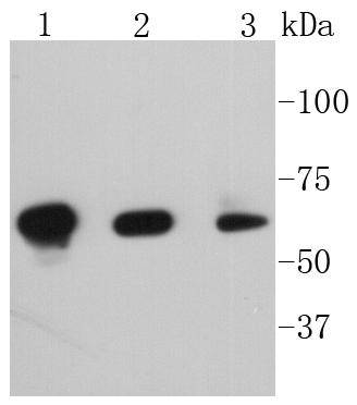 Fig1:; Western blot analysis of Phospho-PAK1(S144)+PAK2(S141)+PAK3(S139) on different lysates. Proteins were transferred to a PVDF membrane and blocked with 5% BSA in PBS for 1 hour at room temperature. The primary antibody ( 1/500) was used in 5% BSA at room temperature for 2 hours. Goat Anti-Rabbit IgG - HRP Secondary Antibody (HA1001) at 1:5,000 dilution was used for 1 hour at room temperature.; Positive control:; Lane 1: Hela cell lysate; Lane 2: NIH/3T3 cell lysate; Lane 2: SH-SY5Y cell lysate