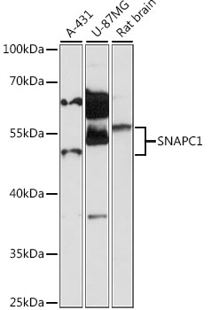 Western blot - SNAPC1 Polyclonal Antibody 
