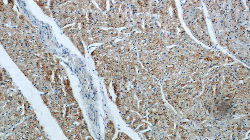 Immunohistochemical of paraffin-embedded human heart using Catalog No:115191(SH3D19 antibody) at dilution of 1:50 (under 10x lens)
