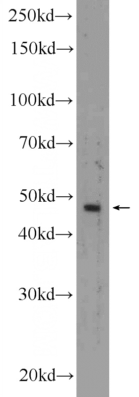 A431 cells were subjected to SDS PAGE followed by western blot with Catalog No:112133(KRT40 Antibody) at dilution of 1:300
