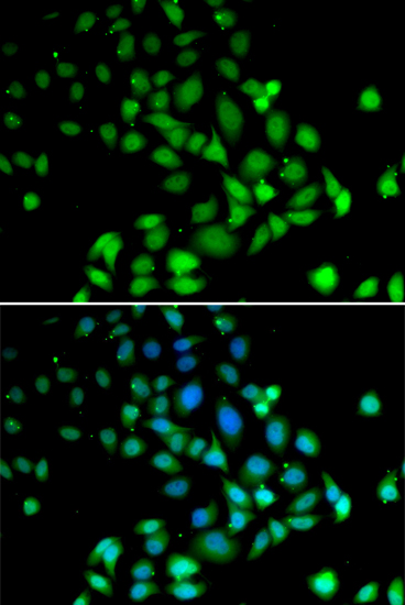 Immunofluorescence - PARN Polyclonal Antibody 
