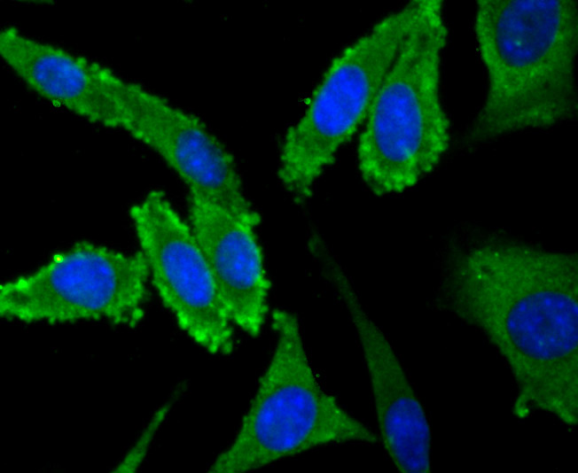 Fig3: ICC staining NaV1.7 in SH-SY5Y cells (green). The nuclear counter stain is DAPI (blue). Cells were fixed in paraformaldehyde, permeabilised with 0.25% Triton X100/PBS.