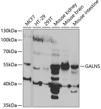Western blot - GALNS Polyclonal Antibody 