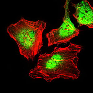Immunofluorescence analysis of HeLa cells using CK5 mouse mAb (green). Red