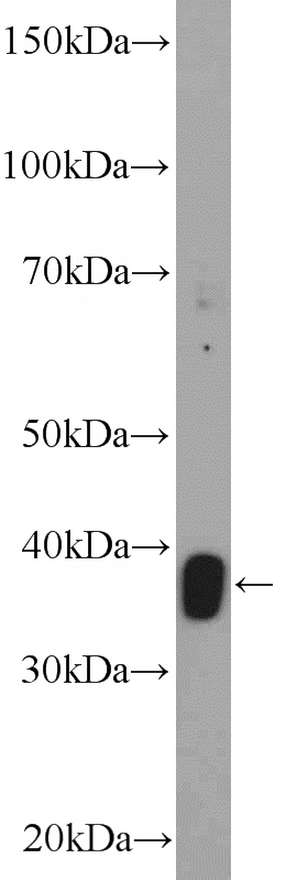 Raji cells were subjected to SDS PAGE followed by western blot with Catalog No:115734(STRADB Antibody) at dilution of 1:300