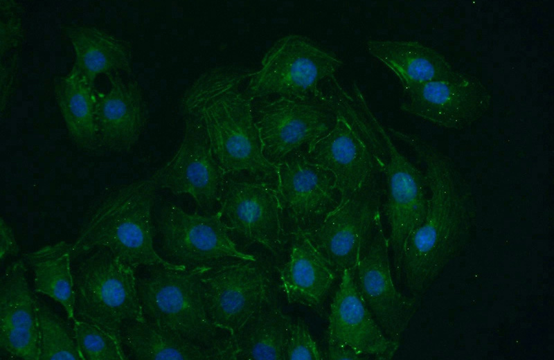 Immunofluorescent analysis of SH-SY5Y cells using Catalog No:116707(VAMP4 Antibody) at dilution of 1:50 and Alexa Fluor 488-congugated AffiniPure Goat Anti-Rabbit IgG(H+L)