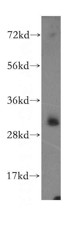 HeLa cells were subjected to SDS PAGE followed by western blot with Catalog No:108270(ASRGL1 antibody) at dilution of 1:500