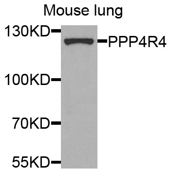 Western blot - PPP4R4 Polyclonal Antibody 
