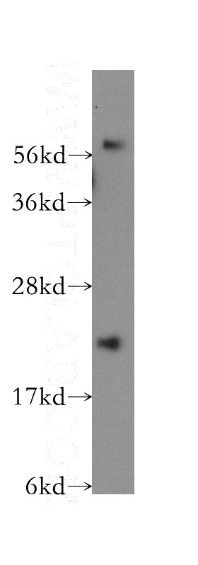 mouse testis tissue were subjected to SDS PAGE followed by western blot with Catalog No:116345(TRAPPC4 antibody) at dilution of 1:400