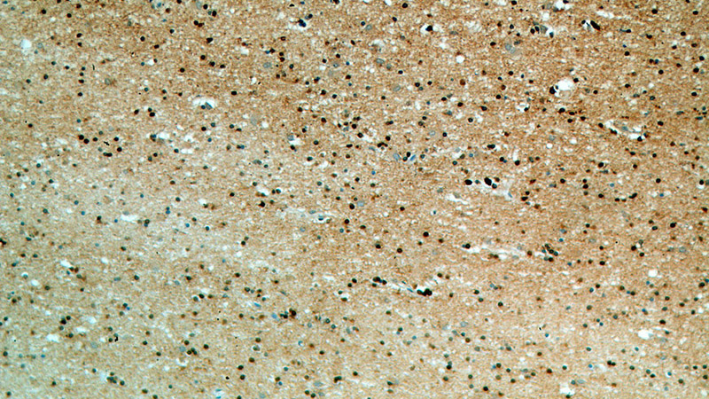 Immunohistochemical of paraffin-embedded human brain using Catalog No:116843(WASL antibody) at dilution of 1:50 (under 10x lens)